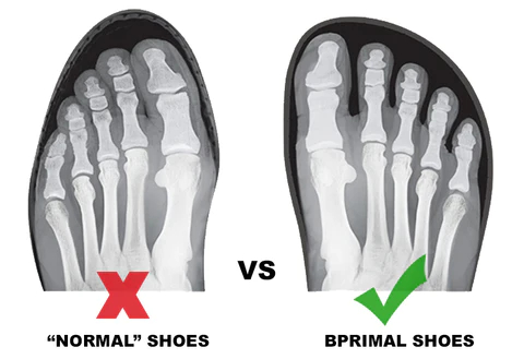 XRAY-IMAGE_480x480_jpg.jpg